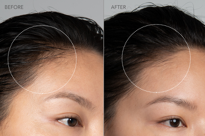 foreo luna 4 hair