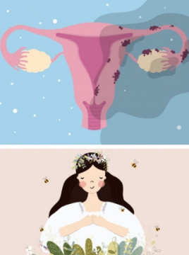 Endometrioza kao važan čimbenik neplodnosti