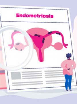 Smrznuta zdjelica: progresivna endometrioza