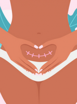 Kako carski porod utječe na menstruaciju?